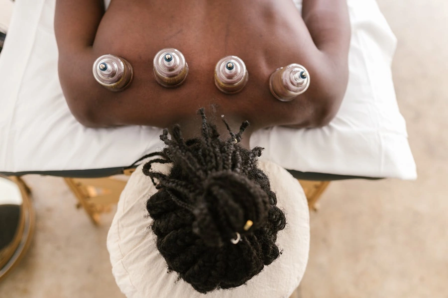 Person having cupping applied to their upper back